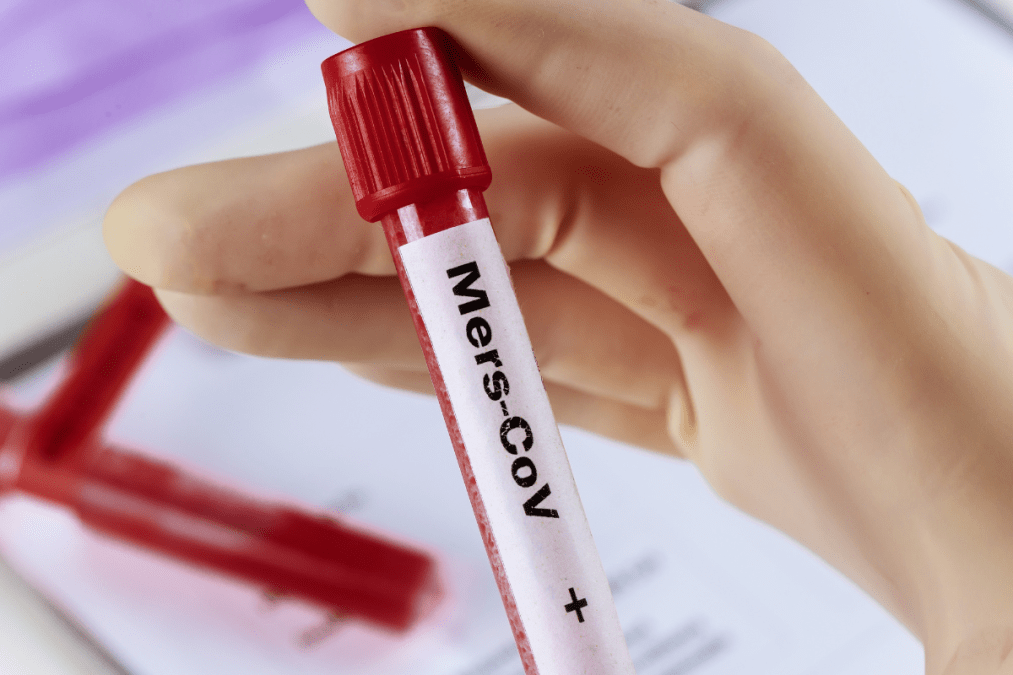 Oxford: PSI begins ChAdOx1 MERS vaccine trial