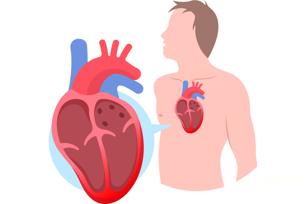 Study: need for clinical surveillance of patients with C-VAM
